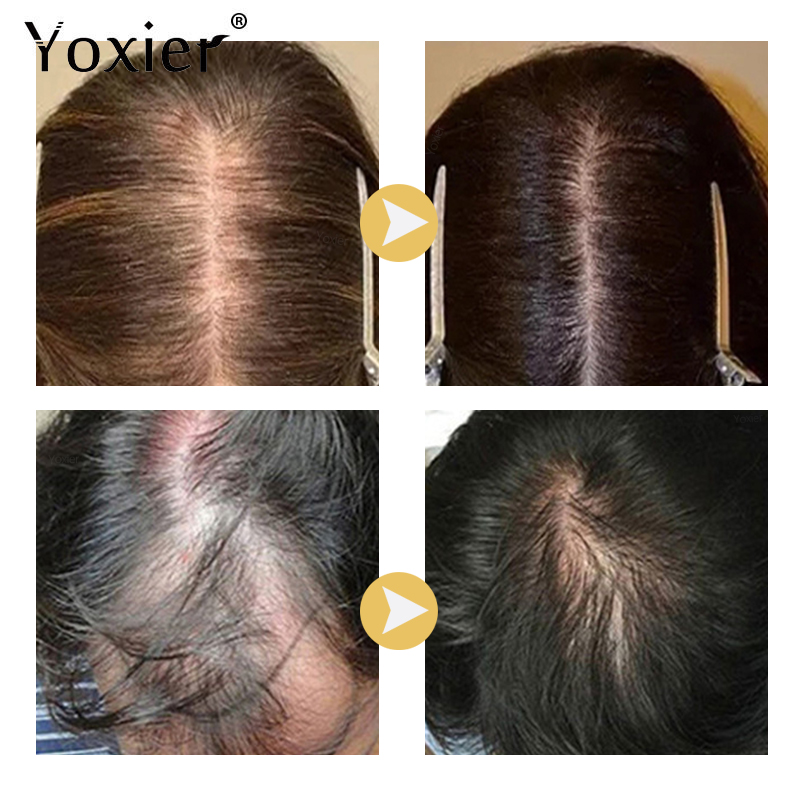 Sérum à croissance Intensive p - Hair Care Treatment avis et prix